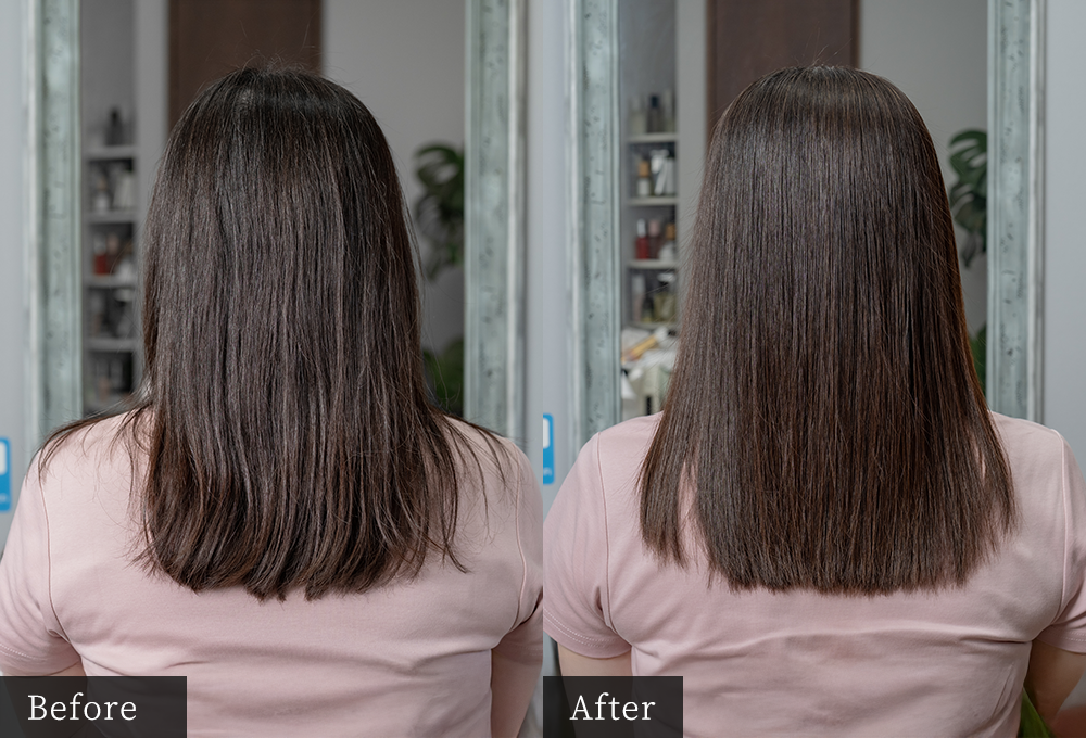 before,after